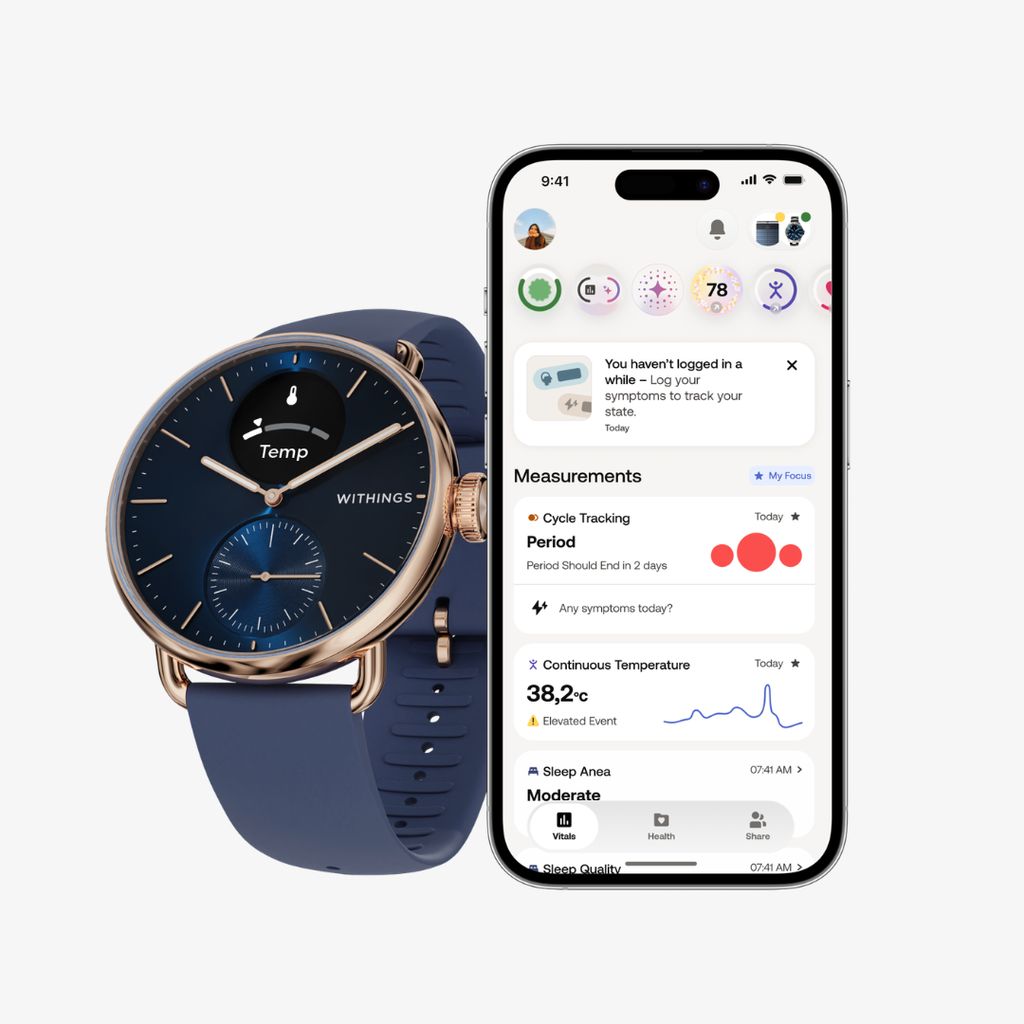 Scanwatch 2 - Rosegold Blue - Image 5